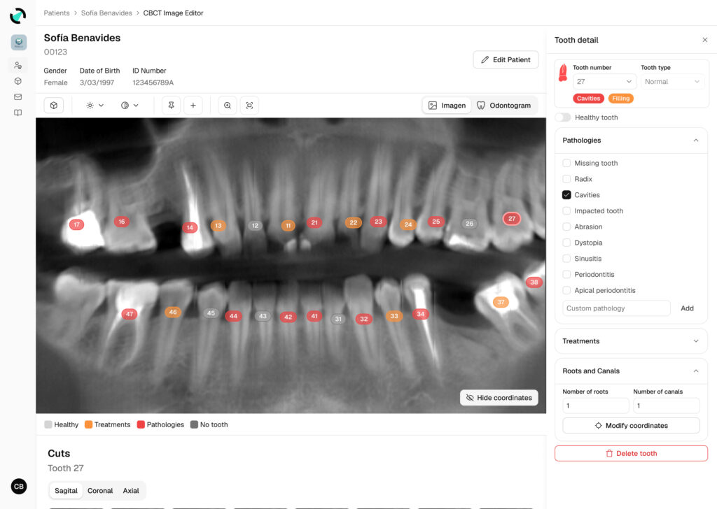Patients-CBCT-SidePanel-Open-EN