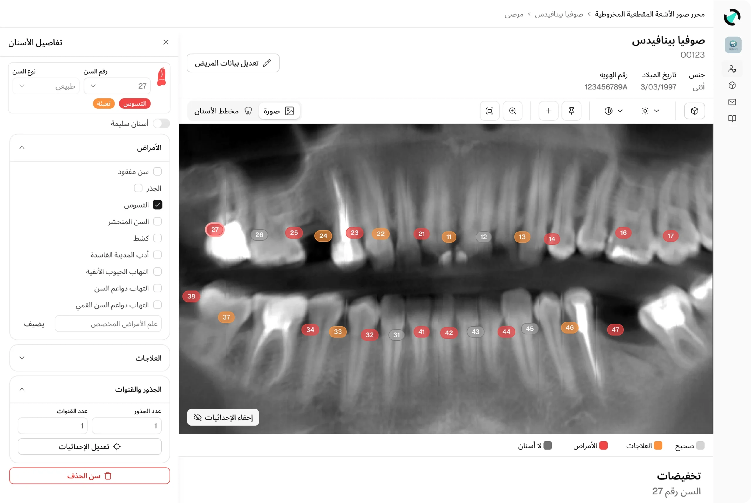 slider-cbct-AR
