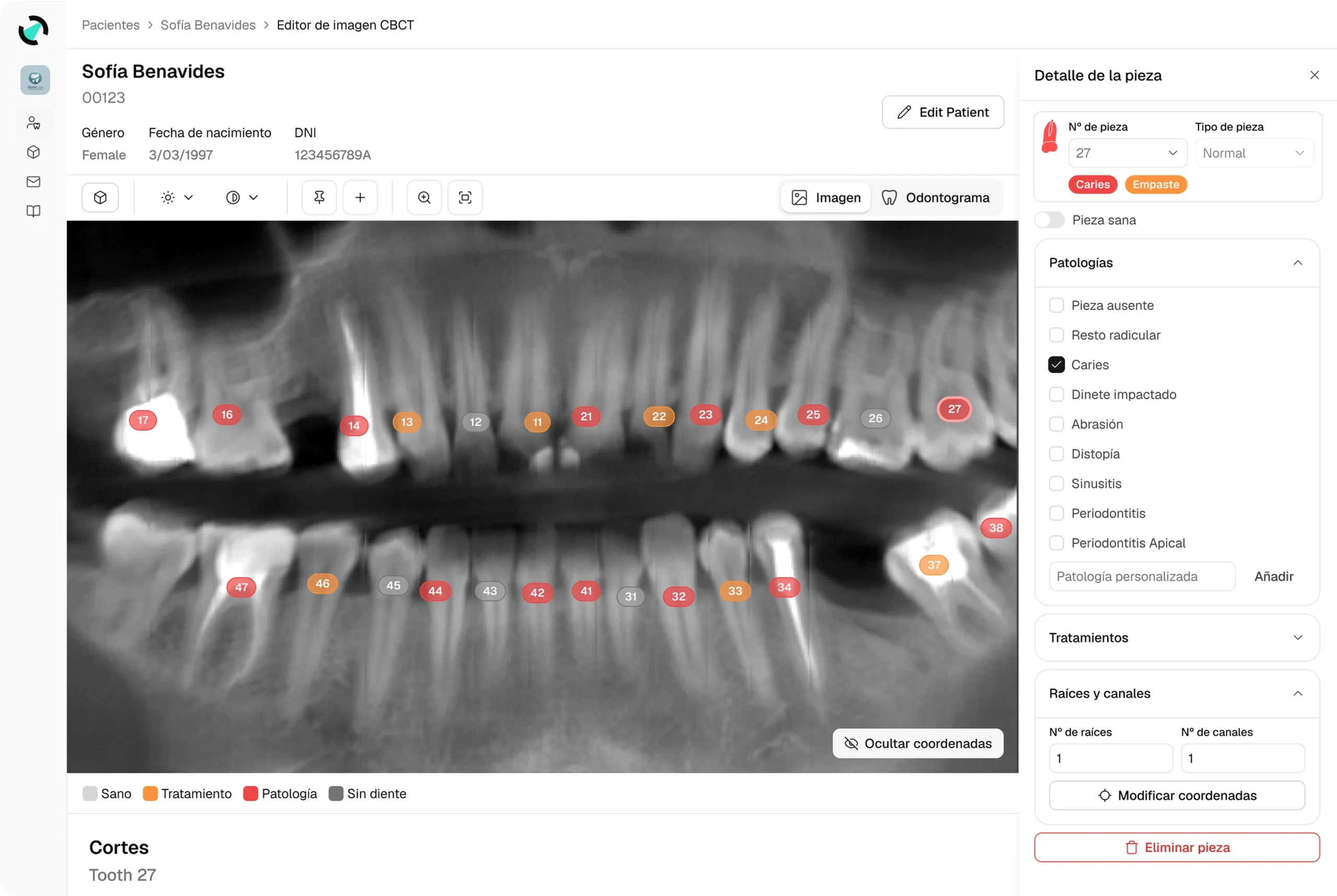 slider-cbct-ES