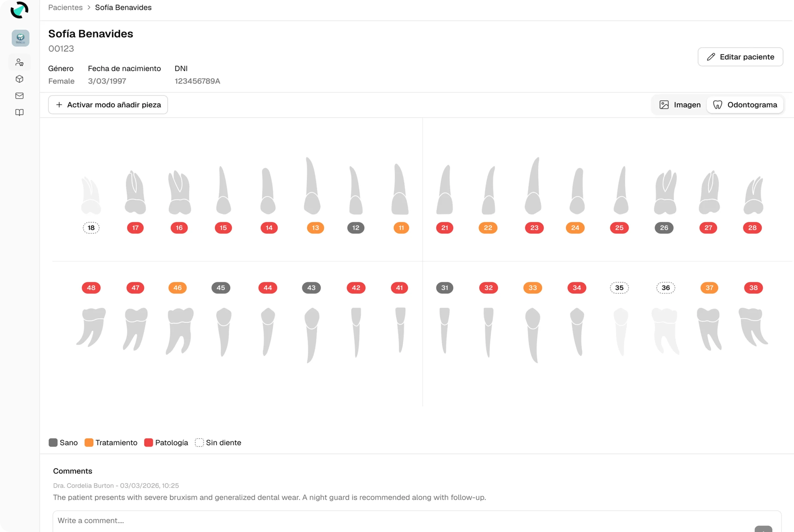 slider-odontogram-ES